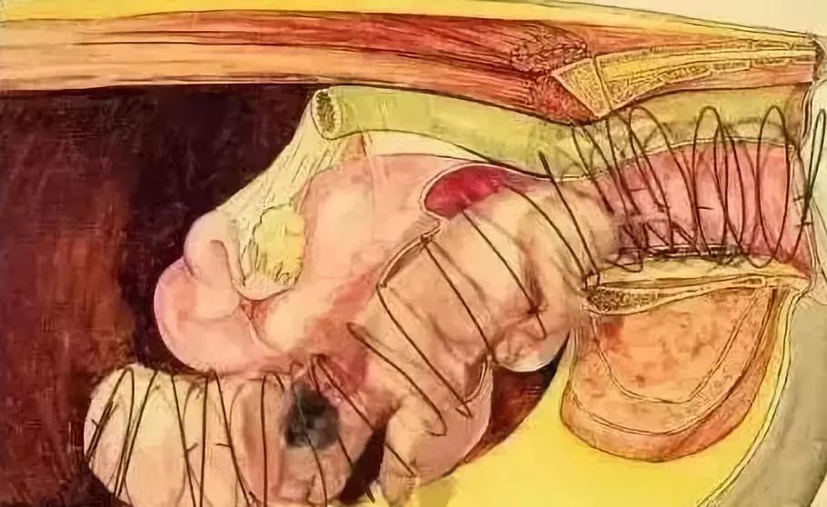 母猪难产掏小猪示范教程,怎样掏难产的母猪