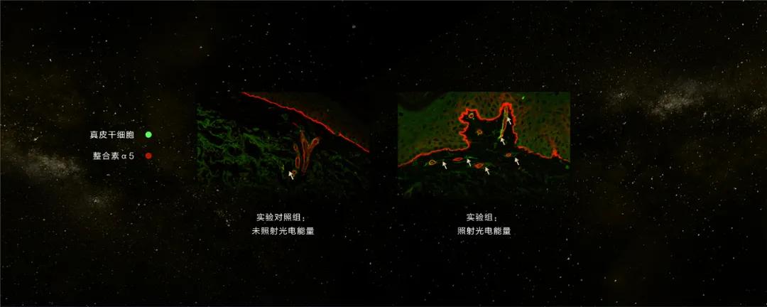 资生堂为什么能上市,松下和资生堂美容仪