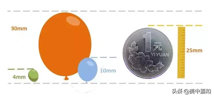 磨玻璃肺结节17mm要不要马上手术,磨玻璃肺结节74mm