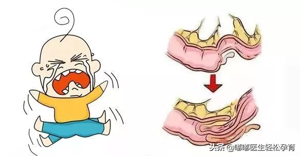 宝宝肚子疼一揉就有水声,宝宝肚子疼一下就没事了怎么回事