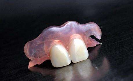 牙齿缺一两颗不种植,牙齿缺失好几颗