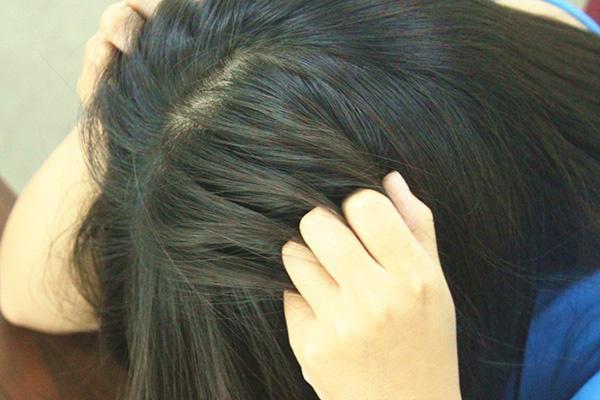 女性唇边长胡子怎么办,女人上唇长胡子是什么原因造成的