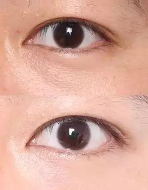 眼霜到底有没有用啊,眼霜里面有什么成分不能用