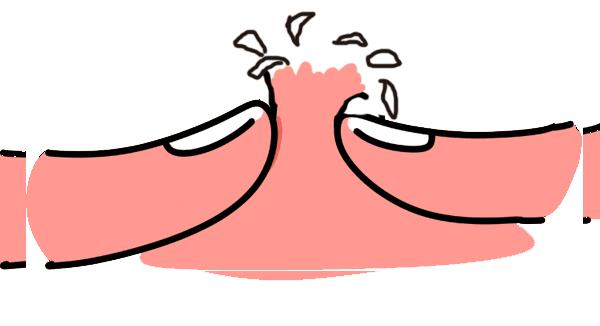 妇产微诊室：生鱼片/皮脂囊肿/按摩/月子姜/乳房湿疹/头发变白