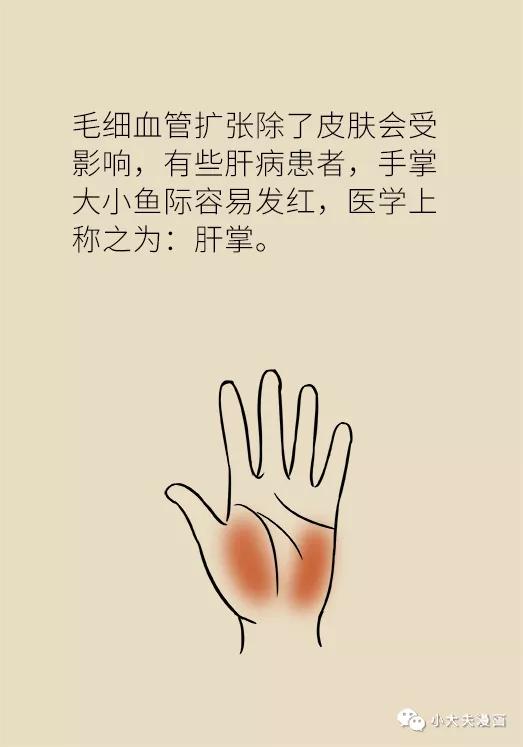 经常洗牙为什么牙周还是肿,经常洗牙会牙龈萎缩吗