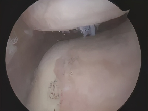 不同部位膝关节,骨科医生教你一招搞定膝盖痛