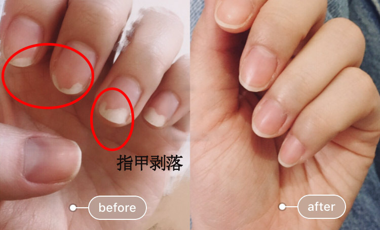 易劈易断还分层？美国专业沙龙修复甲油，给“病甲”快速“整容”