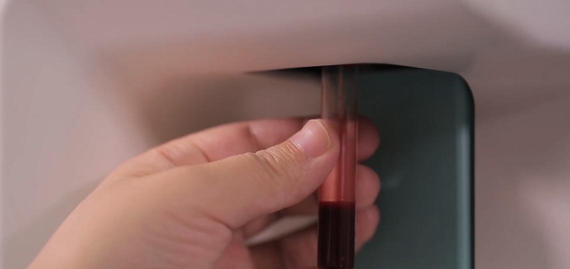 用了激素一个月后脸肿了,化妆品用了一个星期后过敏