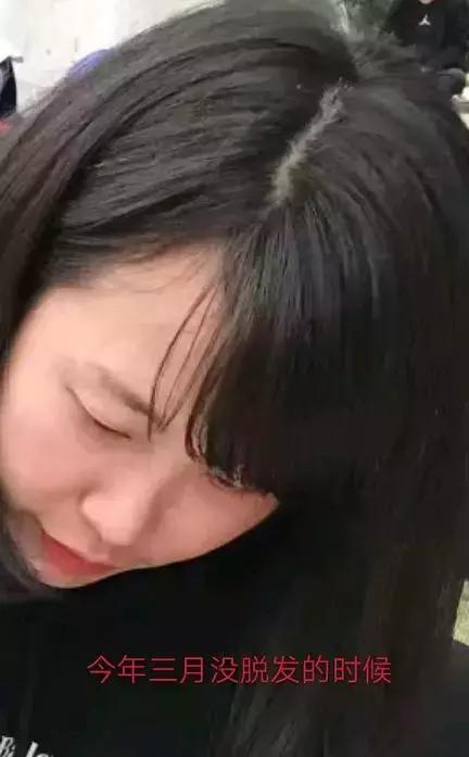 吃了优甲乐身体变瘦为什么,吃了优甲乐还严重起来啥原因