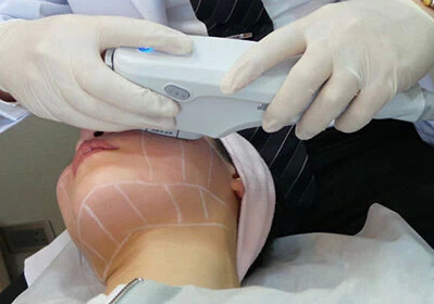 经常说的医美是什么,你真的了解医美吗