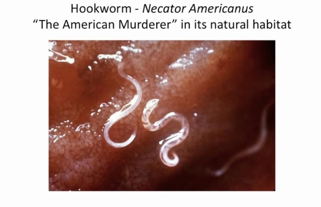 他们生吞3500寄生虫卵，花费1.5万元，只为治疗秃头