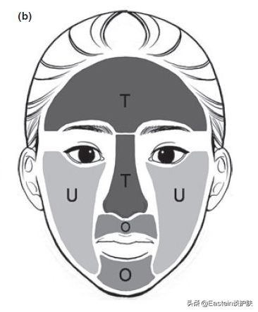 你的皮肤不好的原因,你的皮肤有多少问题