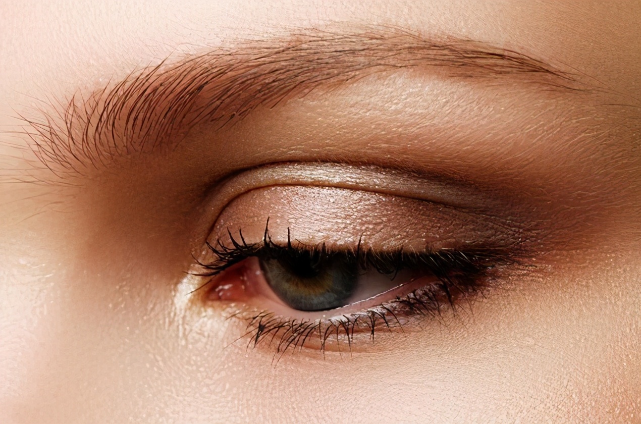 割双眼皮后变单眼皮,微创双眼皮恢复变三眼皮