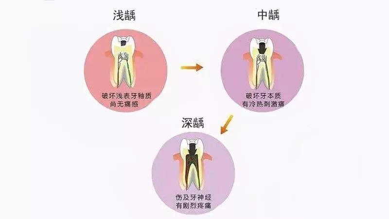 一到晚上就牙疼而且不知道哪个疼,一到晚上牙疼的睡不着