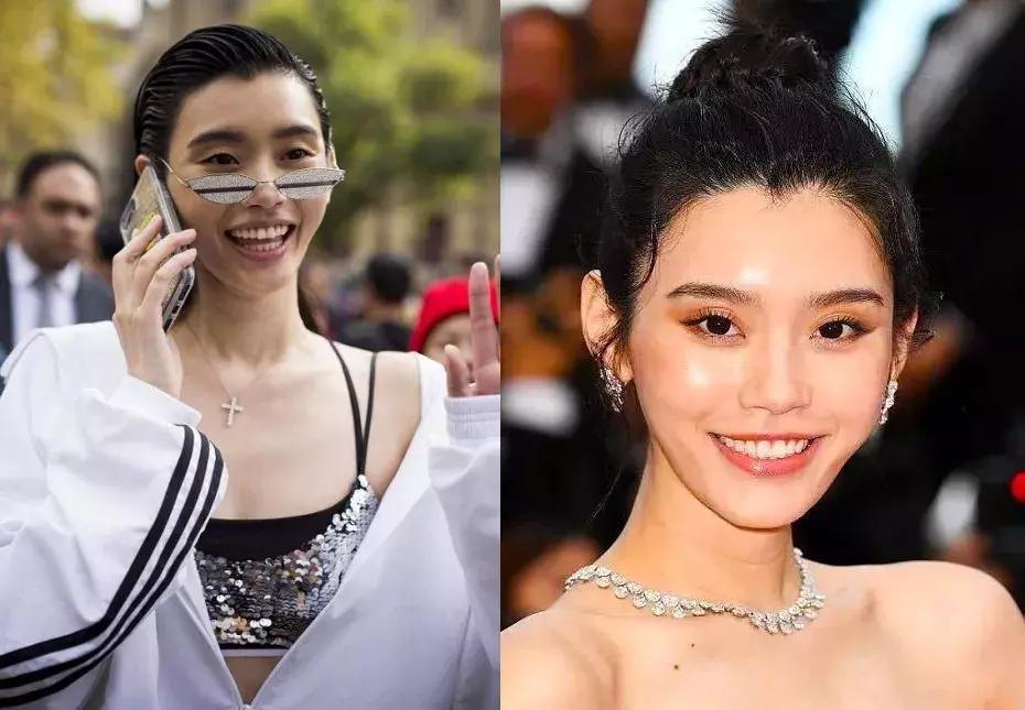 明星如何祛颈纹,女生颈纹很深该怎么解决