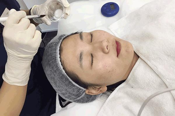 刷酸到底好不好,美容刷酸的副作用是什么