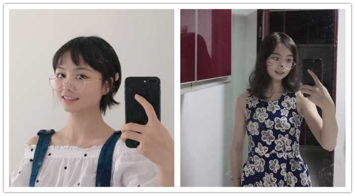 如何改善咬肌鹅蛋脸,咬肌变大脸发腮怎么改善