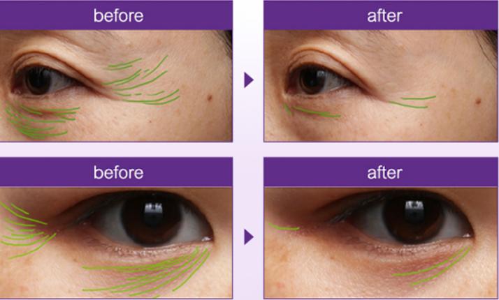 双11olay礼盒,超红瓶眼霜olay超值购