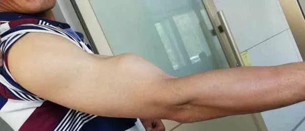 手臂像大力水手一样,手臂像大力水手