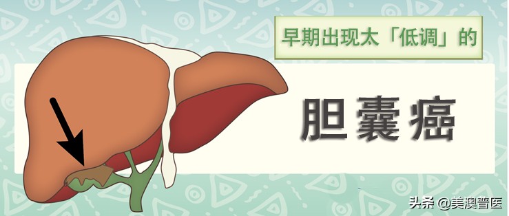 胆结石不治疗多久会转变为癌,胆结石不治疗会越来越严重吗