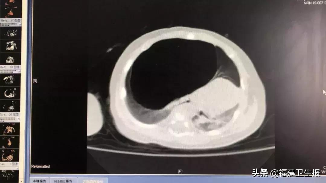 福建一2个月大*儿命婴**悬一线,只因父母疏忽了这件事!孕期一定要注意这些事