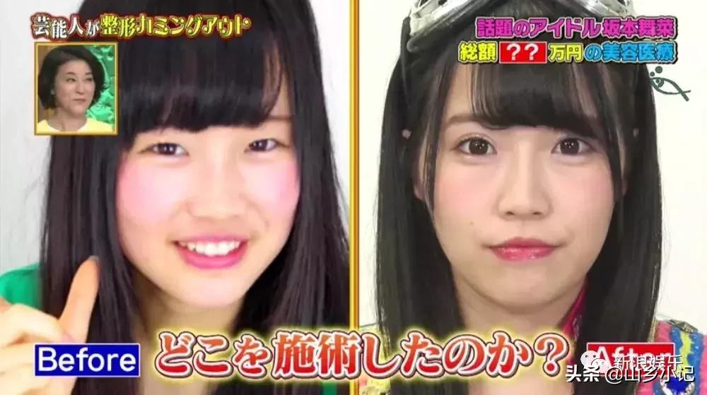 明明是整容脸现在却成了颜值巅峰,明明是整容脸却没被吐槽过