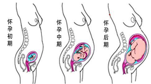 盆底肌,剖宫产有必要做盆底康复吗