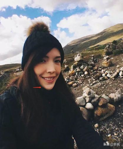 盘点整容后不敢认的女星颜值巅峰,知名女网红被扒整容