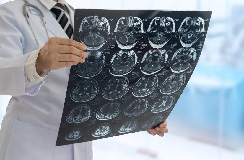 NUV-422治胶质瘤获FDA孤儿药资格，图解胶质瘤治疗流程