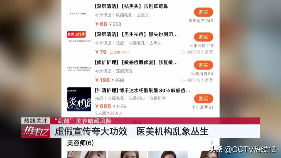 刷酸祛痘焕肤,刷酸能去激素脸的痘痘吗