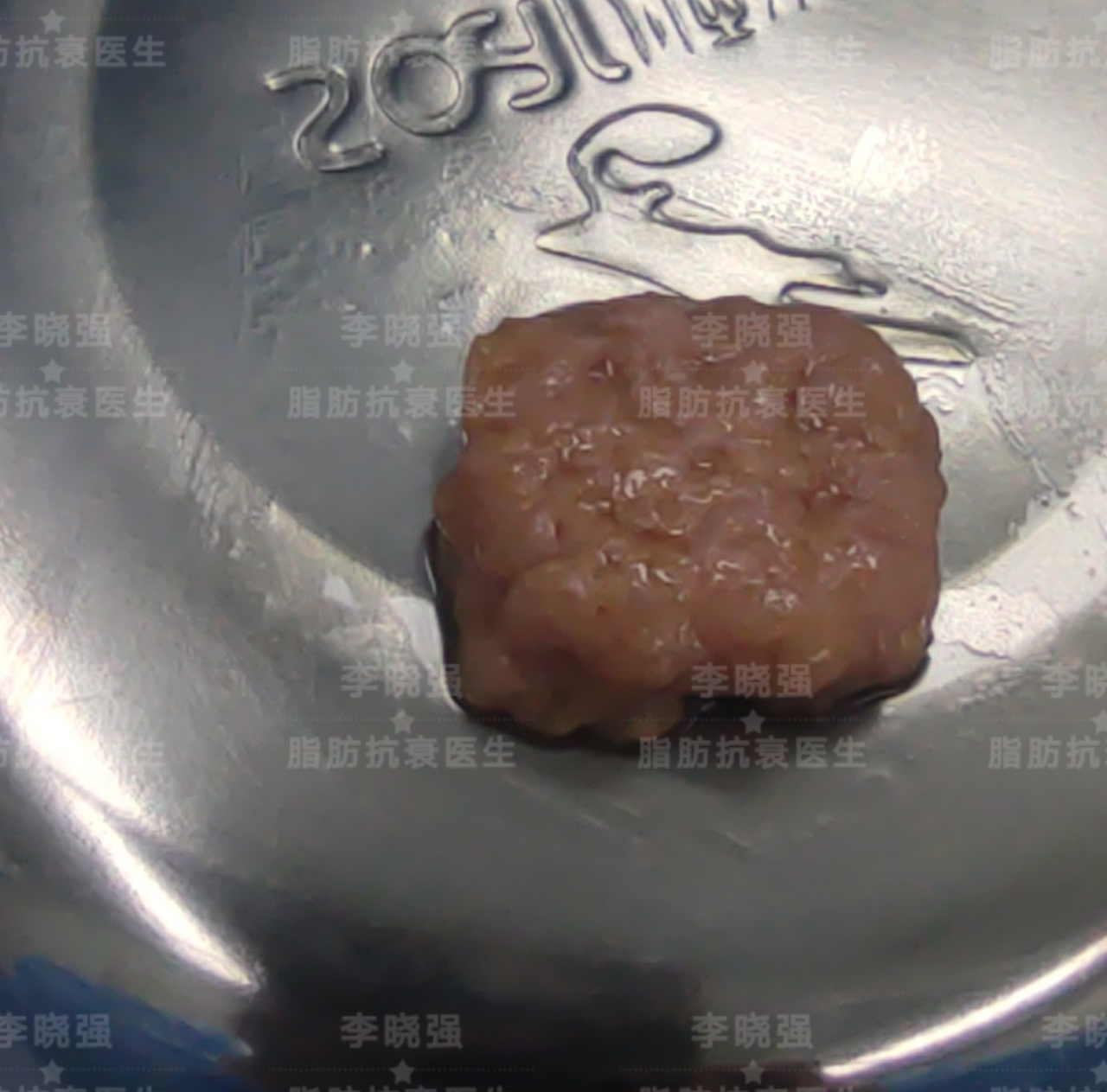 怎样让五官变立体整形,五官轮廓整形