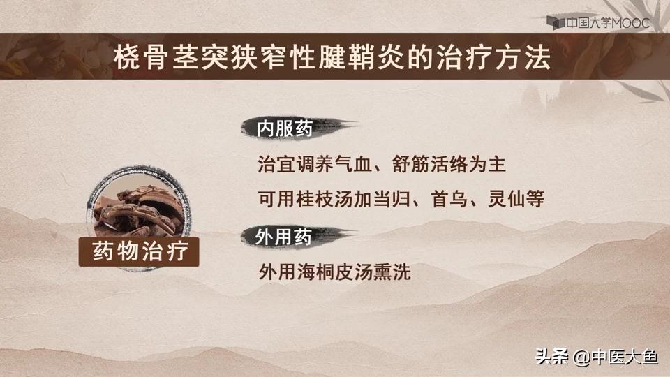 桡骨茎突狭窄性腱鞘炎怎么治疗,桡骨茎突狭窄性腱鞘炎治疗方法