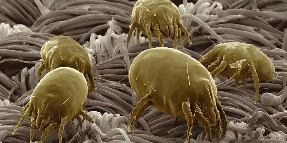 洗澡搓下一堆“黑泥”，真脏吗？显微镜下一群密密麻麻的小东西