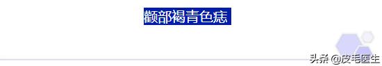 雀斑黄褐斑老年斑祛斑方法,褐斑老年斑怎么治疗效果最好