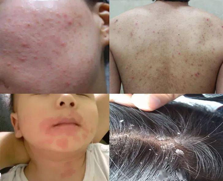 英国珀婷pertine除螨喷雾剂,瑞士珀婷pertine除螨喷雾剂