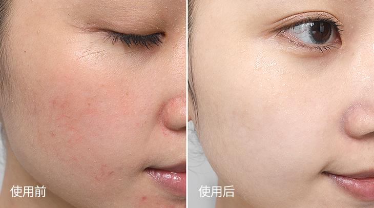 越敷越白胶原蛋白面膜,越敷皮肤越嫩的泥膜