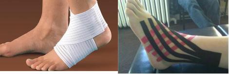 踝关节扭伤正确的处理方式是什么,踝关节扭伤的表现及处理方法