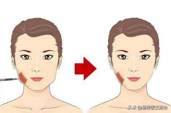 怎么改善大小脸不对称问题,左右脸严重不对称图片怎么改善