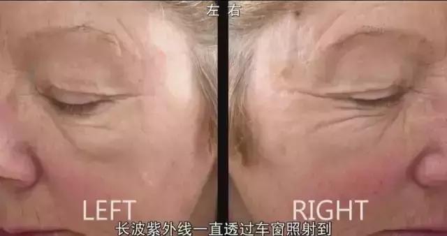 bbc纪录片整形美容的真相,美容治疗的真相bbc