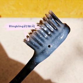 满口全瓷牙的明星李沁,李沁矫正牙齿前的照片