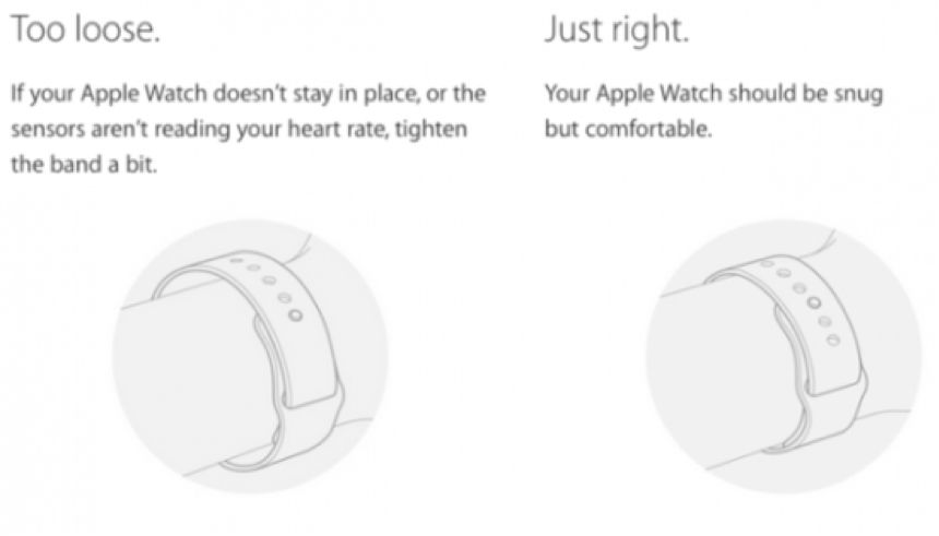 戴applewatch过敏,applewatch佩戴过敏