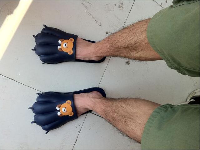 腿部突然出现问题,腿部出现异常信号