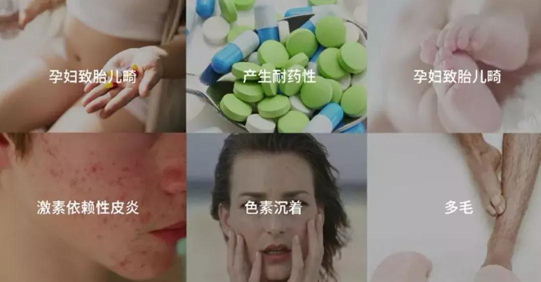 海得宝治疗什么,海得宝有没有激素