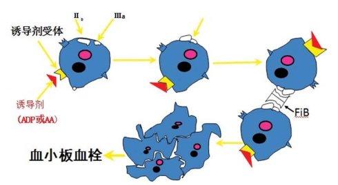 妊娠期紫癜性血小板减少,妊娠相关性血小板减少的护理措施