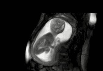 孕妇数胎动的最佳时间是什么时候,孕期数胎动正确方法