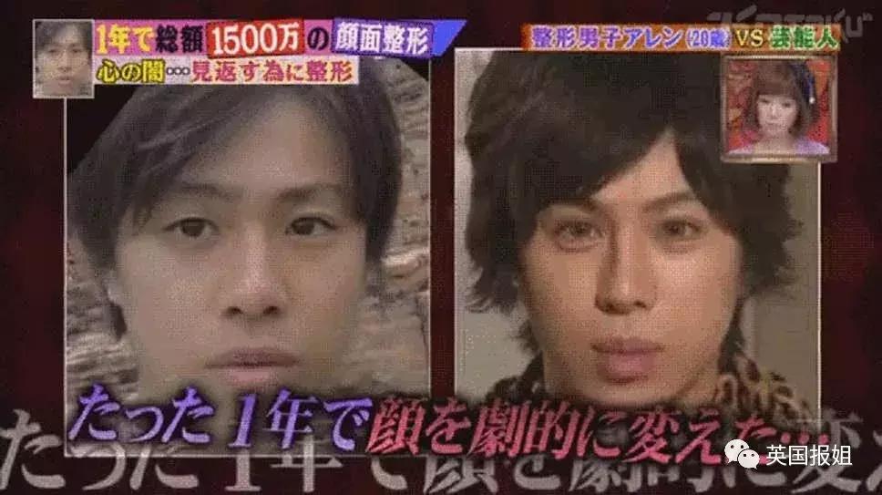 日本男子花费200万整容变成狗,日本整容小哥
