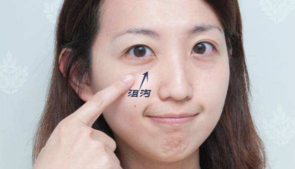 眼袋越来越严重赶紧试试这个方法,大家是否知道眼袋形成的原因呢