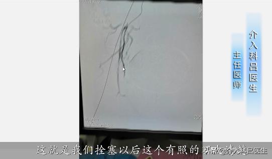 医生给你用图片讲解:前列腺增生如何微创治疗,一看就懂!