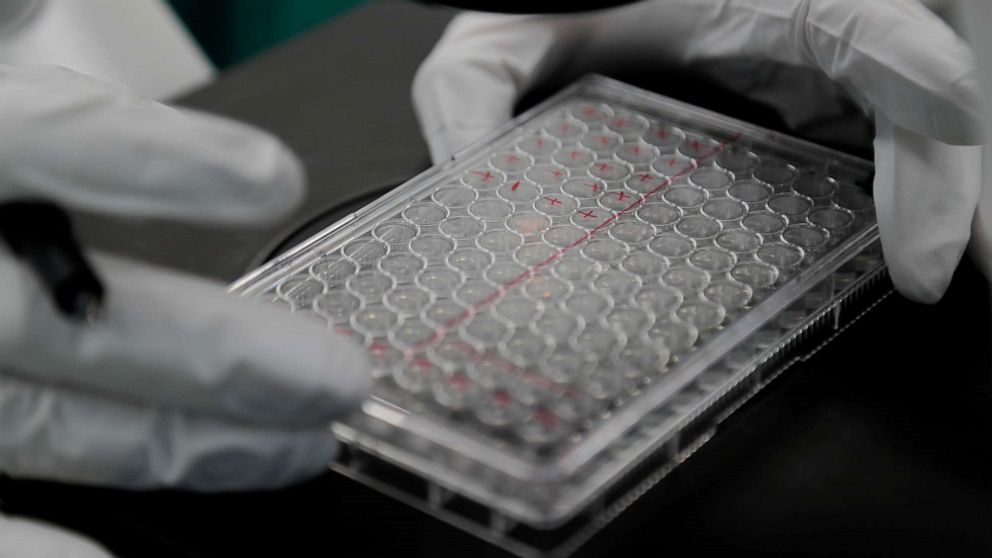 为什么纽约卫生部喊大家疫情期间不要接吻？