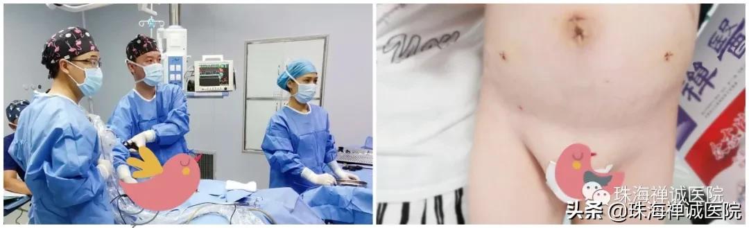 3岁男宝个头小,男婴儿出生只有一个蛋怎么办